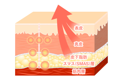 피부층